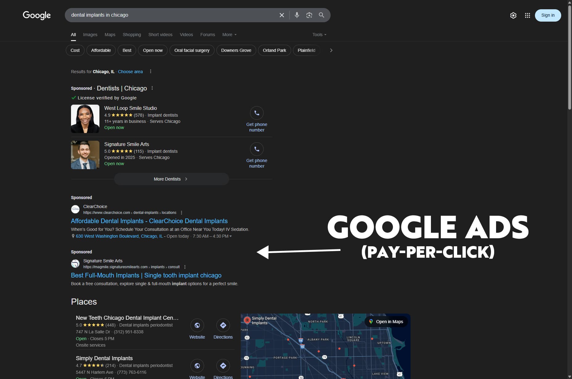Google Ads (PPC) search result